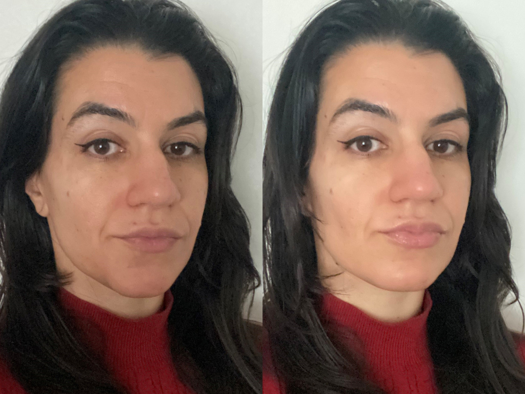 Before and after Dr Dennis Gross lip plumping product | Space NK